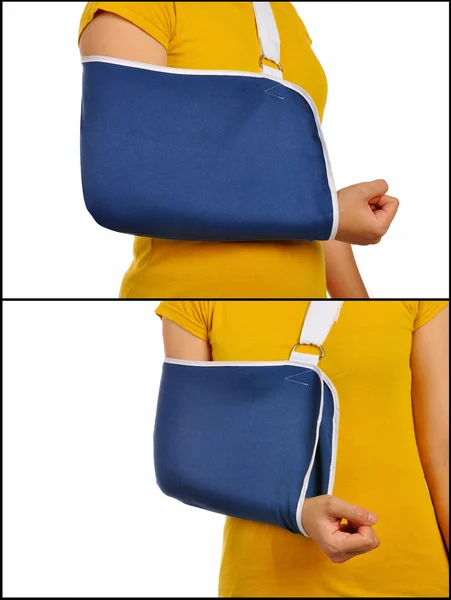 Suporte médico Mão Sling — Fotografia de Stock