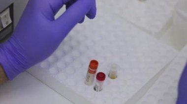 Bir sağlık çalışanının elleri. Bir tıp laboratuarında araştırmacıyım. Laboratuvarda test tüpleriyle yakın plan çekimde çalışıyorum.