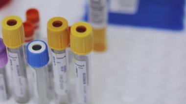 Tıbbi test tüpleri yakın çekim. Tıbbi ekipman. Tıbbi analizler