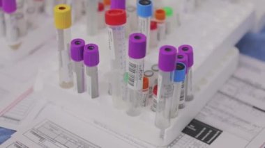 Tıbbi test tüpleri yakın çekim. Tıbbi ekipman. Tıbbi analizler