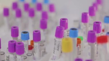 Tıbbi test tüpleri yakın çekim. Tıbbi ekipman. Tıbbi analizler