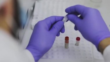Bir sağlık çalışanının elleri. Bir tıp laboratuarında araştırmacıyım. Laboratuvarda test tüpleriyle yakın plan çekimde çalışıyorum.