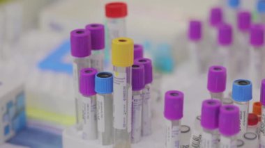 Tıbbi test tüpleri yakın çekim. Tıbbi ekipman. Tıbbi analizler