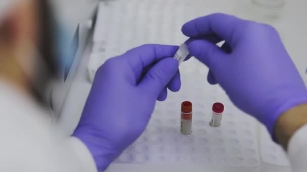 Hands of a medical worker close up. Researcher in a medical laboratory. Working with test tubes in the laboratory close-up — Stock Video