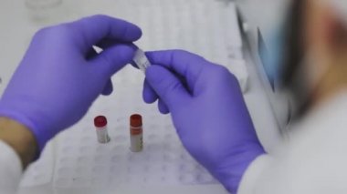 Laboratuvarda test tüpleriyle yakın plan çekimde çalışıyorum. Bir sağlık çalışanının elleri. Bir tıp laboratuarında araştırmacı..