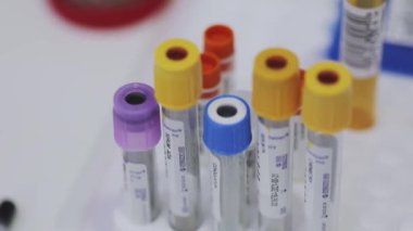 Tıbbi ekipman. Tıbbi analizler. Tıbbi test tüpleri yakın çekim.