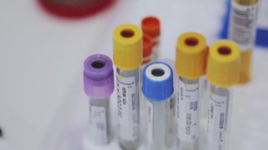 Tıbbi ekipman. Tıbbi analizler. Tıbbi test tüpleri yakın çekim.