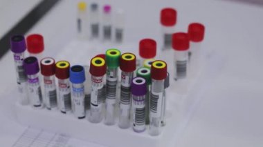 Tıbbi ekipman. Tıbbi analizler. Tıbbi test tüpleri yakın çekim.