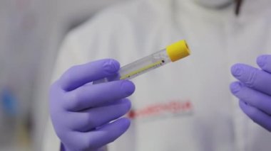 Laboratuvar asistanı test tüplerini yakından inceliyor. Erkek laboratuvar asistanı laboratuardaki test tüplerini inceliyor.