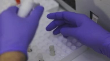 Bir tıp laboratuarında araştırmacıyım. Bir sağlık çalışanının elleri. Laboratuvarda test tüpleriyle yakın plan çekimde çalışıyorum.
