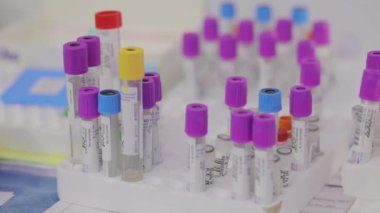 Tıbbi test tüpleri yakın çekim. Tıbbi ekipman. Tıbbi analizler