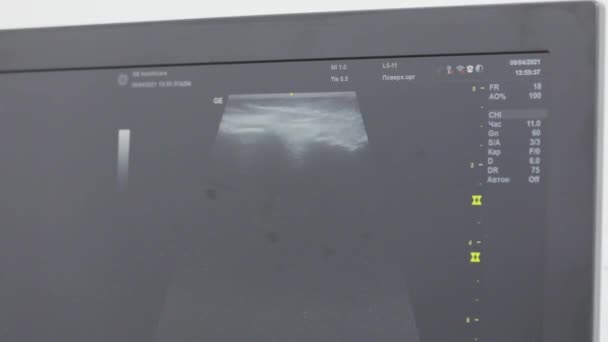 De arts maakt een ultrasone scan met behulp van moderne apparatuur. De dokter maakt diagnostiek op een ultrageluid machine. Onderzoek van de knie van een persoon met behulp van een ultrasoon apparaat. — Stockvideo