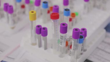 Tıbbi test tüpleri yakın çekim. Tıbbi ekipman. Tıbbi analizler