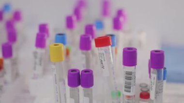 Tıbbi ekipman. Tıbbi analizler. Tıbbi test tüpleri yakın çekim.