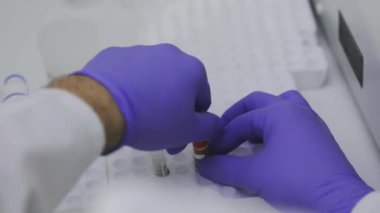 Bir sağlık çalışanının elleri. Bir tıp laboratuarında araştırmacıyım. Laboratuvarda test tüpleriyle yakın plan çekimde çalışıyorum.