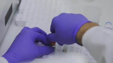Bir tıp laboratuarında araştırmacıyım. Bir sağlık çalışanının elleri. Laboratuvarda test tüpleriyle yakın plan çekimde çalışıyorum.