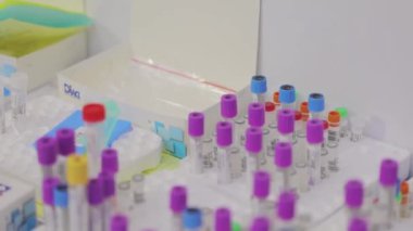 Tıbbi test tüpleri yakın çekim. Tıbbi ekipman. Tıbbi analizler