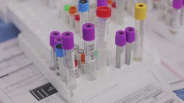 Tıbbi ekipman. Tıbbi analizler. Tıbbi test tüpleri yakın çekim.