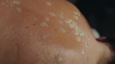 Balmumu masajı. Bir kadının sırtına ağda damlaları. Sırt masajı. Kız sırt masajı yaptırıyor. Kozmetik prosedürler. Genç tanınmayan bir kadın sırt masajı yaptırıyor.