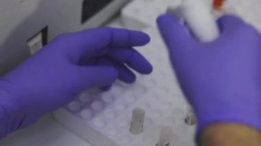 Bir sağlık çalışanının elleri. Bir tıp laboratuarında araştırmacıyım. Laboratuvarda test tüpleriyle yakın plan çekimde çalışıyorum.