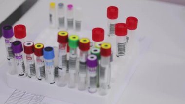 Tıbbi ekipman. Tıbbi analizler. Tıbbi test tüpleri yakın çekim.