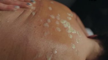 Balmumu masajı. Bir kadının sırtına ağda damlaları. Sırt masajı. Kız sırt masajı yaptırıyor. Kozmetik prosedürler. Genç tanınmayan bir kadın sırt masajı yaptırıyor.