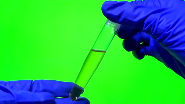 Urintest Reagenzglas Auf Grünem Hintergrund Schaum Urin Männlicher Urin Mit — Stockvideo