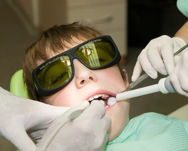 Perforación de dientes — Foto de Stock