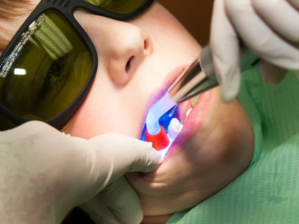 Enchimento dentário para menino — Fotografia de Stock