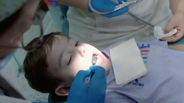 Kadın dişçi, klinikteki küçük bir çocuğun bebek dişlerini muayene ediyor. Kadın profesyonel dişçi iş başında. Diş muayenesi konsepti. Çocuklarla çalışan dişçi. Sağlık ve Tıp Konsepti.