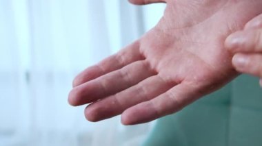 Avuçta çok kuru, çatlak deri, sorunlu cilt, dermatolojik tedavi gereklidir. yakın plan.