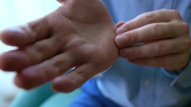 Avuçta çok kuru, çatlak deri, sorunlu cilt, dermatolojik tedavi gereklidir. yakın plan.