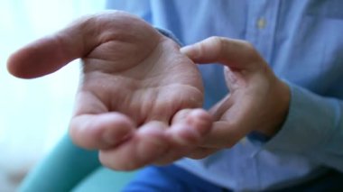 Avuçta çok kuru, çatlak deri, sorunlu cilt, dermatolojik tedavi gereklidir. yakın plan.