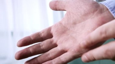 Avuçta çok kuru, çatlak deri, sorunlu cilt, dermatolojik tedavi gereklidir. yakın plan.