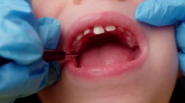 Dişçide ağzı açık çocuk, diş fırçalama ultrasonu yapan elleri kapalı dişçi. Kadın profesyonel dişçi iş başında. Diş kontrolü konsepti. Dişçi çocuklarla çalışır