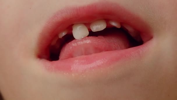 Primo Piano Bocca Bambini Tirando Fuori Dente Latte Cambio Denti — Video Stock