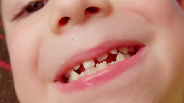 Primer Plano Boca Los Niños Sacando Diente Leche Cambio Dientes — Vídeo de stock