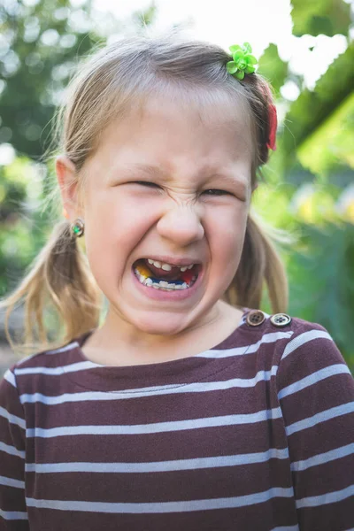 Dziecko Ortodontą Dentystyczną Bez Jednego Zęba — Zdjęcie stockowe
