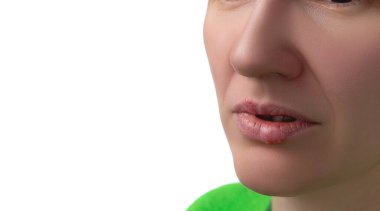 Herpes virüsü. 30 yaşındaki bir kadının dudaklarında uçuk hastalığı. Bulaşıcı virüs. Dudaklardaki uçuk belirtilerinin yakın plan görüntüsü. Stüdyo fotoğrafı beyaz arkaplanda izole edildi