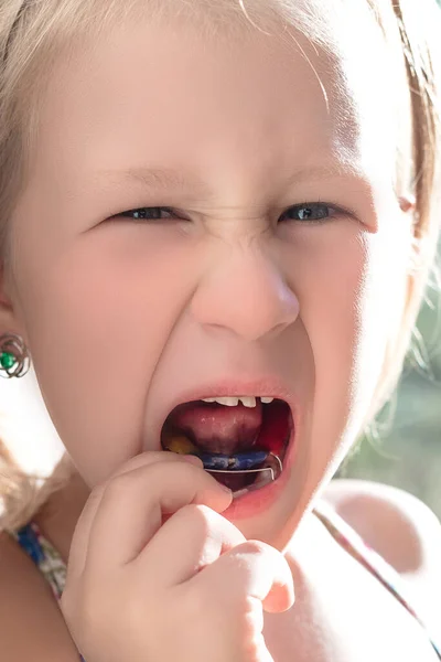 Menina Mostra Aparelho Ortodôntico Uma Criança Com Dentes Tortos Dente — Fotografia de Stock
