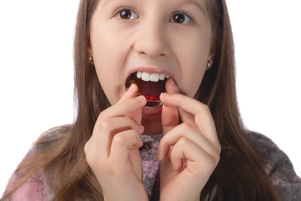 Słodka Dziewczynka Wkłada Urządzenie Ortodontyczne Koncepcja Higieny Jamy Ustnej Dzieciństwie — Zdjęcie stockowe