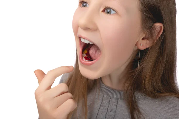 Uma Menina Fofa Aponta Para Aparelho Ortodôntico Sua Boca Sua — Fotografia de Stock