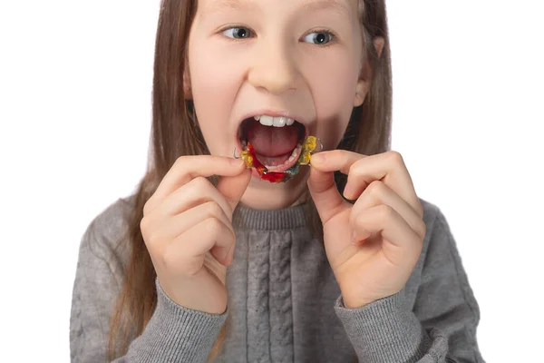 Słodka Dziewczynka Wkłada Urządzenie Ortodontyczne Koncepcja Higieny Jamy Ustnej Dzieciństwie — Zdjęcie stockowe