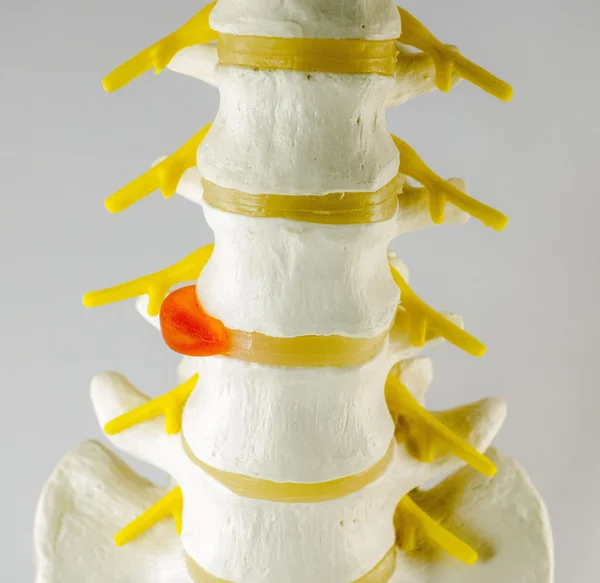 Vertebra model Royalty Free Stock Images