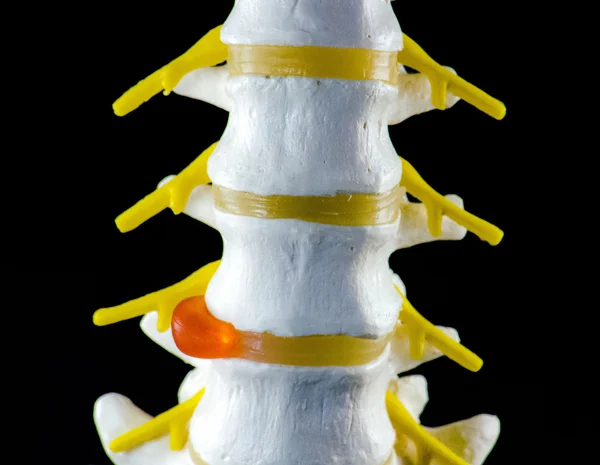 Modelo de columna vertebral, modelo de vértebra — Foto de Stock