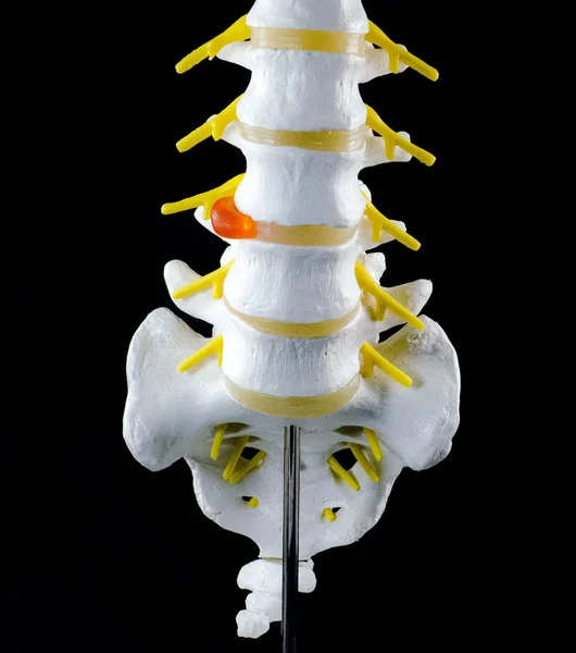 Modelo de columna vertebral, modelo de vértebra Imagen de stock