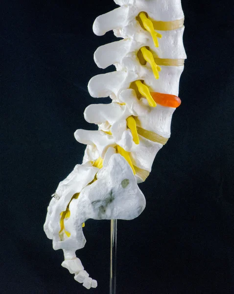 Spine model, vertebra model Stock Picture
