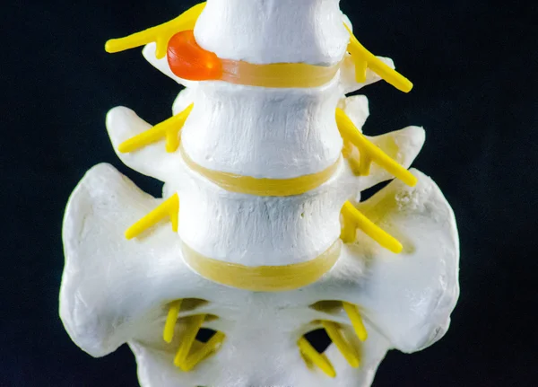 Spine model, vertebra model Royalty Free Stock Images