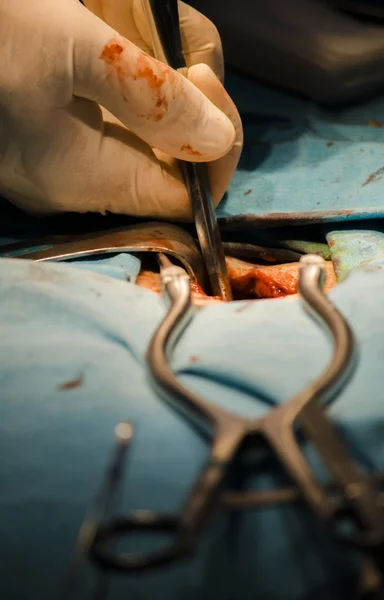 Neurokirurgiska operation — Stockfoto