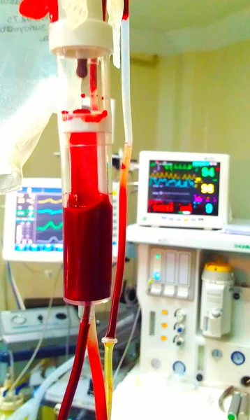 Blodtransfusion — Stockfoto